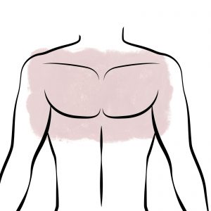 סדרת לייזר חזה מלא גבר – 12 טיפולים